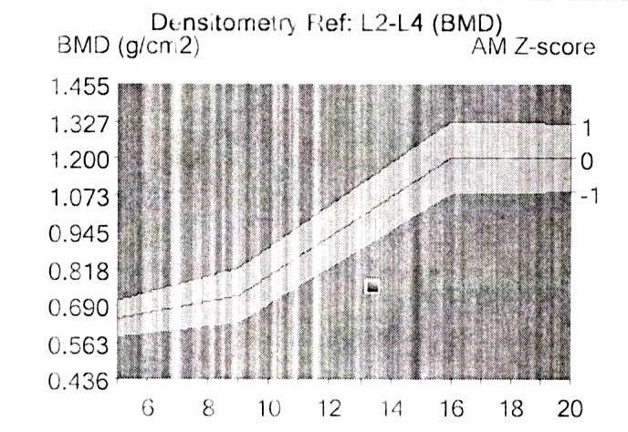 W badaniu DXA wartość masy kostnej BMD odc.