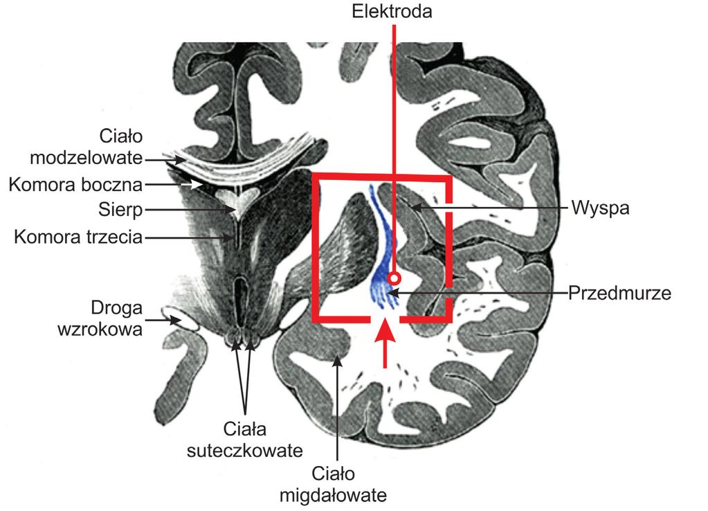 Stany świadomości w świetle neuronauk 77 dzo mały obszar mózgu (ograniczony do kilku milimetrów), znajdujący się z lewej strony mózgowia oraz przednio-grzbietowej części wyspy.