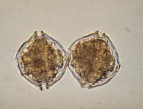 tamarense Około 140 chromosomów