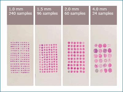 Macierze tkankowe TMA ang. Tissue microarray Technika opisana w 1987 roku (Wan i wsp., 1987), opracowana w 1998 roku.