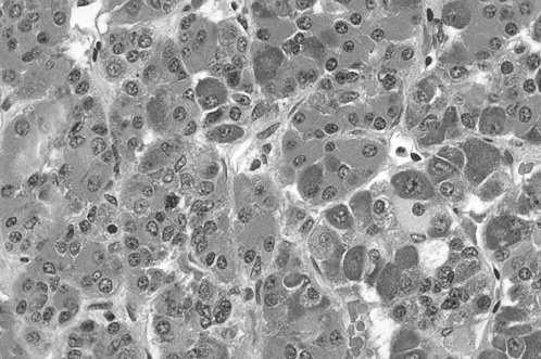 duże komórki neurosekretoryczne (jąder wielkokomórkowych, nadwzrokowego i przykomorowego) produkują ADH i oksytocynę, które transportowane są długimi aksonami do wyrostka lejkowatego i tam uwalniane