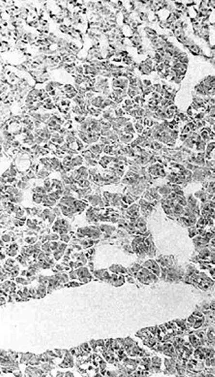 aldosteron) warstwa pasmowata warstwa siatkowata duże, jasne komórki z licznymi kroplami lipidowymi