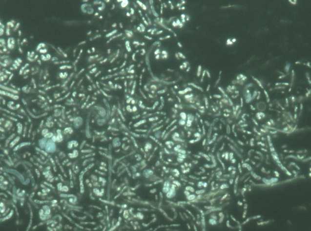 Zdjęcie mikroorganizmów przy obiektywie 100x (imersji) w świetle widzialnym Fig. 5. Photo microorganism at objective x100 in visible light Rys. 6.