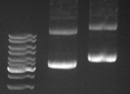 precypitują, natomiast plazmidowe DNA pozostaje w roztworze dzięki swojej specyficznej konformacji. Uzyskana ilość plazmidowego DNA może dochodzić nawet do 20 μg z 5ml całonocnej hodowli bakteryjnej.