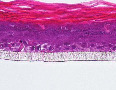 c. Modele naskórka in vitro i analiza genomu Naukowcy z Laboratoires Expanscience, jako pierwsi na świecie, użyli keratynocytów do stworzenia modeli i zbadania naskórka małych dzieci w