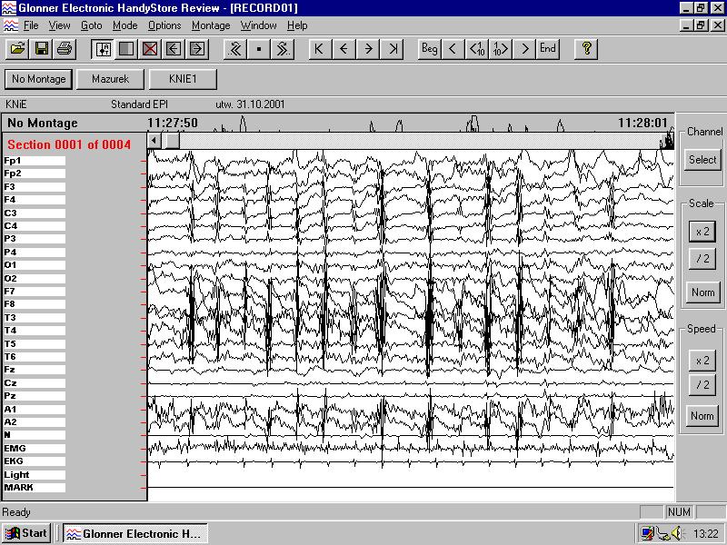 Zapisy EEG