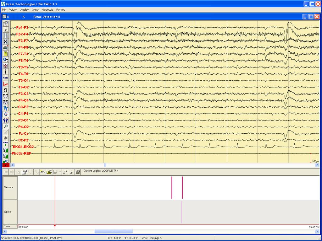 Zapisy EEG 24h