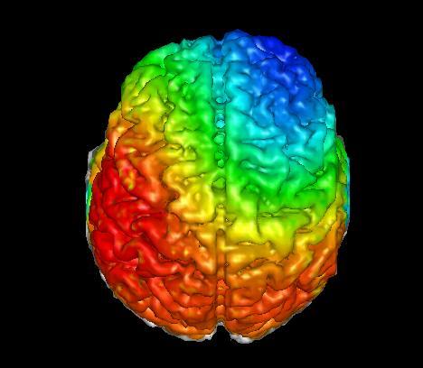 EEG + MRI