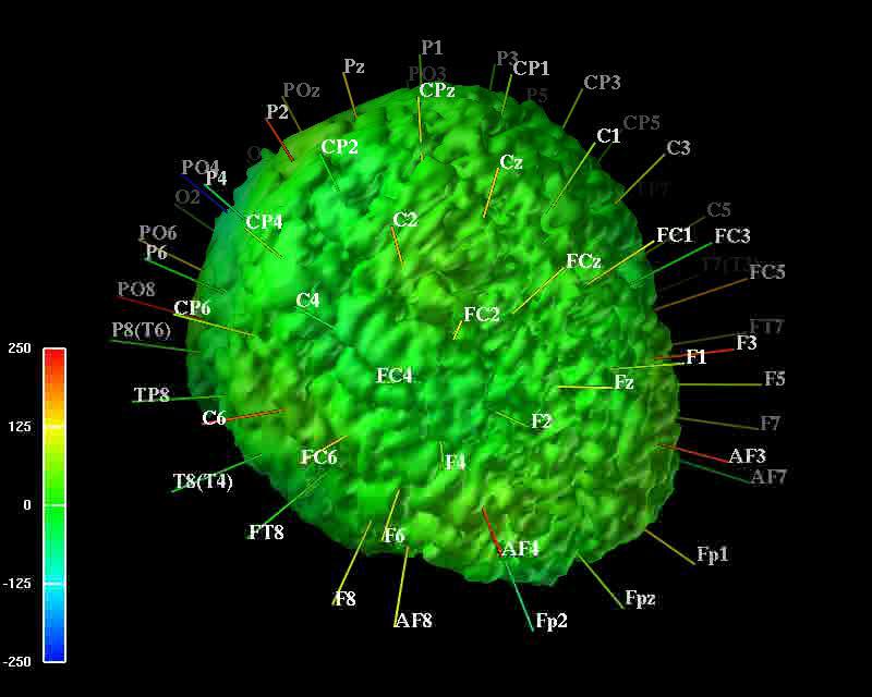 EEG + MRI