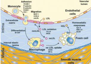 Rozwój miażdżycy - mikrourazy śródbłonka - napływ leukocytów (głównie