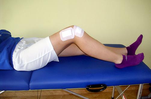 Opis przypadku Dziewiętnastoletnia pacjentka, trenująca piłkę nożną w ekstraligowym klubie piłkarskim, doznała urazu prawego kolana podczas treningu.