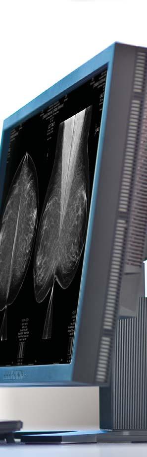 Ten zestaw graficznych narzędzi klinicznych zbiera informacje medyczne pacjenta, radiologiczną historię mammograficzną, wyniki badań