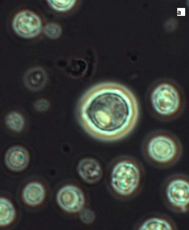 Nr 3-4 Patogenność grzybów z rodzaju Cryptococcus 223 human blood (27,32).