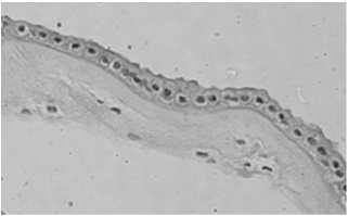 Przykładowa lokalizacja: naczynia (śródbłonek),