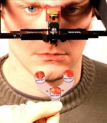 Zamocuj widelec zgryzowy na łuku twarzowym za pomocą łącznika 3D