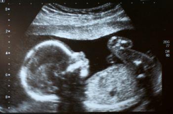 prenatalne badania ultrasonograficzne