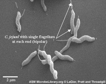 Rodzina Campylobacteriaceae Gatunki ważne: C.coli,, C. faecalis, C. fetus sp., C. hominis, C.