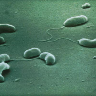 Campylobacter sp. Genom Campylobacter jejuni składa się z 1,641,481 par zasad, zawiera 1,654 genów kodujących białka. Geny kodujace produkcję kwasu sialowego warunkują m.