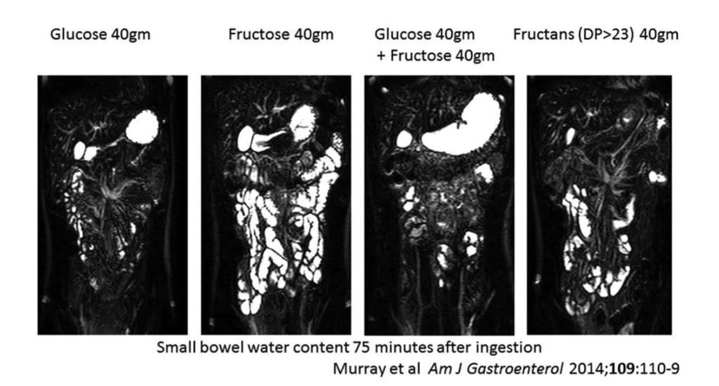 FODMAPs