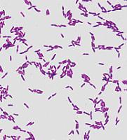 Lactobacillus Znaczenie mają gatunki: Lactobacillus acidophilus, Lactobacillus bifidus i Lactobacillus odontolyticus.