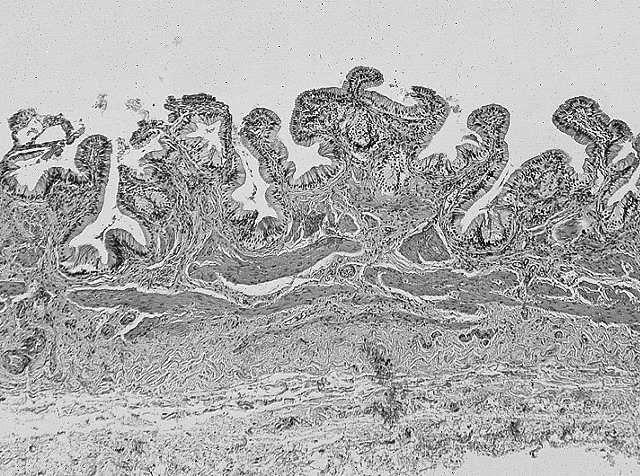 bogaty w wodorowęglany Komórki owalne to komórki macierzyste wątroby: