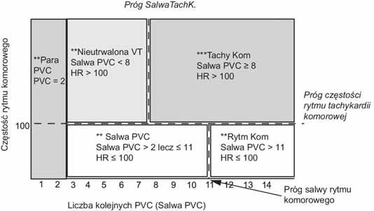 6 Monitorowanie EKG, arytmii, odcinka ST i odstępu QT Przykłady układu logicznego łańcuchów alarmów W przypadku wystąpienia alarmu bigeminii komorowej alarm PVC > xx/min nie będzie sygnalizowany,