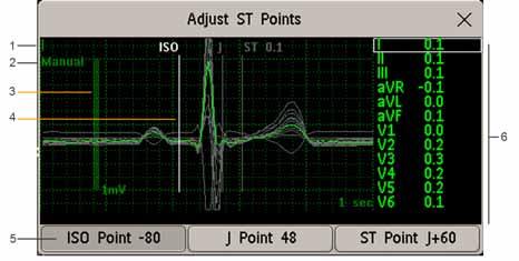 6 Monitorowanie EKG, arytmii, odcinka ST i odstępu QT 3 Użyj przycisku kontekstowego Wybierz punkt, aby wybrać z listy żądany punkt.