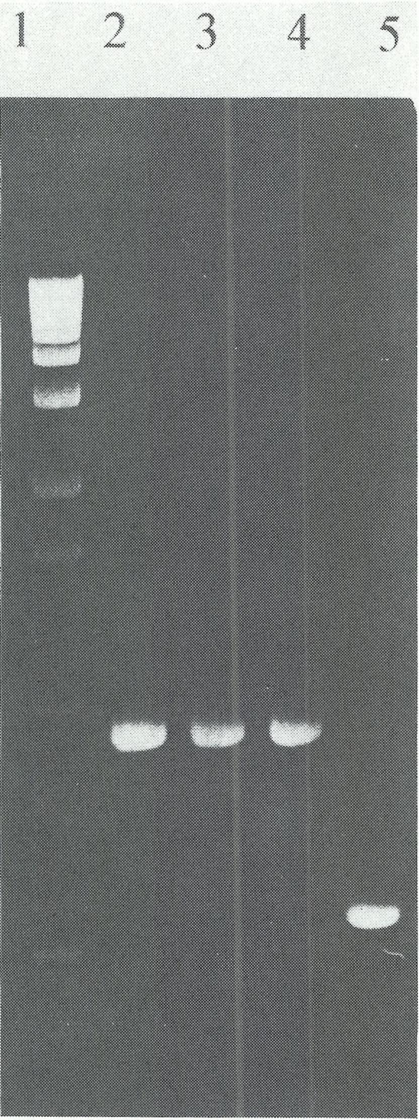 Tor 1, marker wielkości KBL (GIBCO). duktów PCR, wielkość fragmentów uzyskanych po działaniu enzymem restrykcyjnym oraz genotypy badanych osób przedstawiono w tabeli 4.