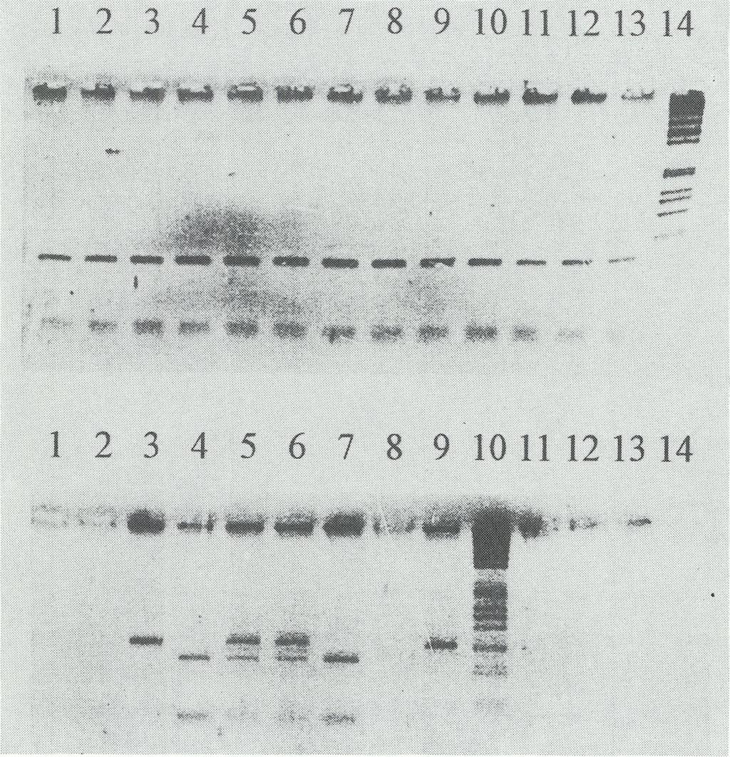 kolejności: pacjent, ojciec, matka, siostra 1 i siostra 2; tor 14 marker wielkości KBL. Zdjęcie dolne produkt PCR regionu pert 87.15 o wielkości 216, 166 i 50 pz po trawieniu enzymem BamHI.