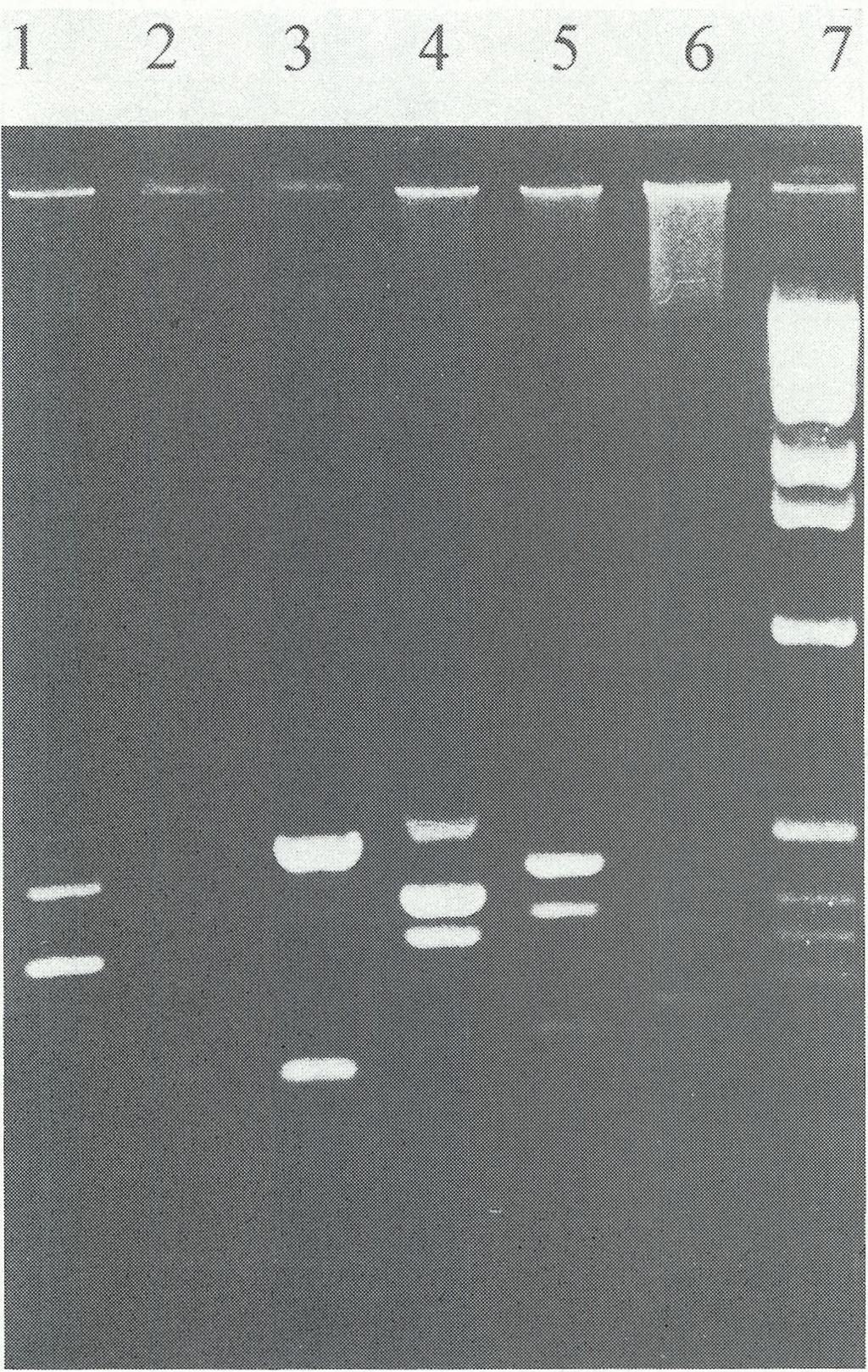 6 (202 pz), 46 (140pz); tor 4 produkty PCR zawierające eksony: 45 (547 pz), 17 (416 pz), 43 (357 pz); tor 5 produkty PCR zawierające eksony: 19 (459 pz), 51 (388 pz), 13 (238 pz), 47 (181 pz); tor 6