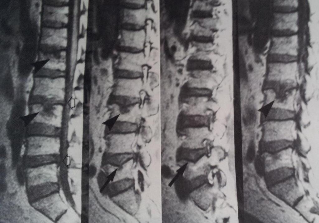 DIAGNOSTYKA RÓŻNICOWA