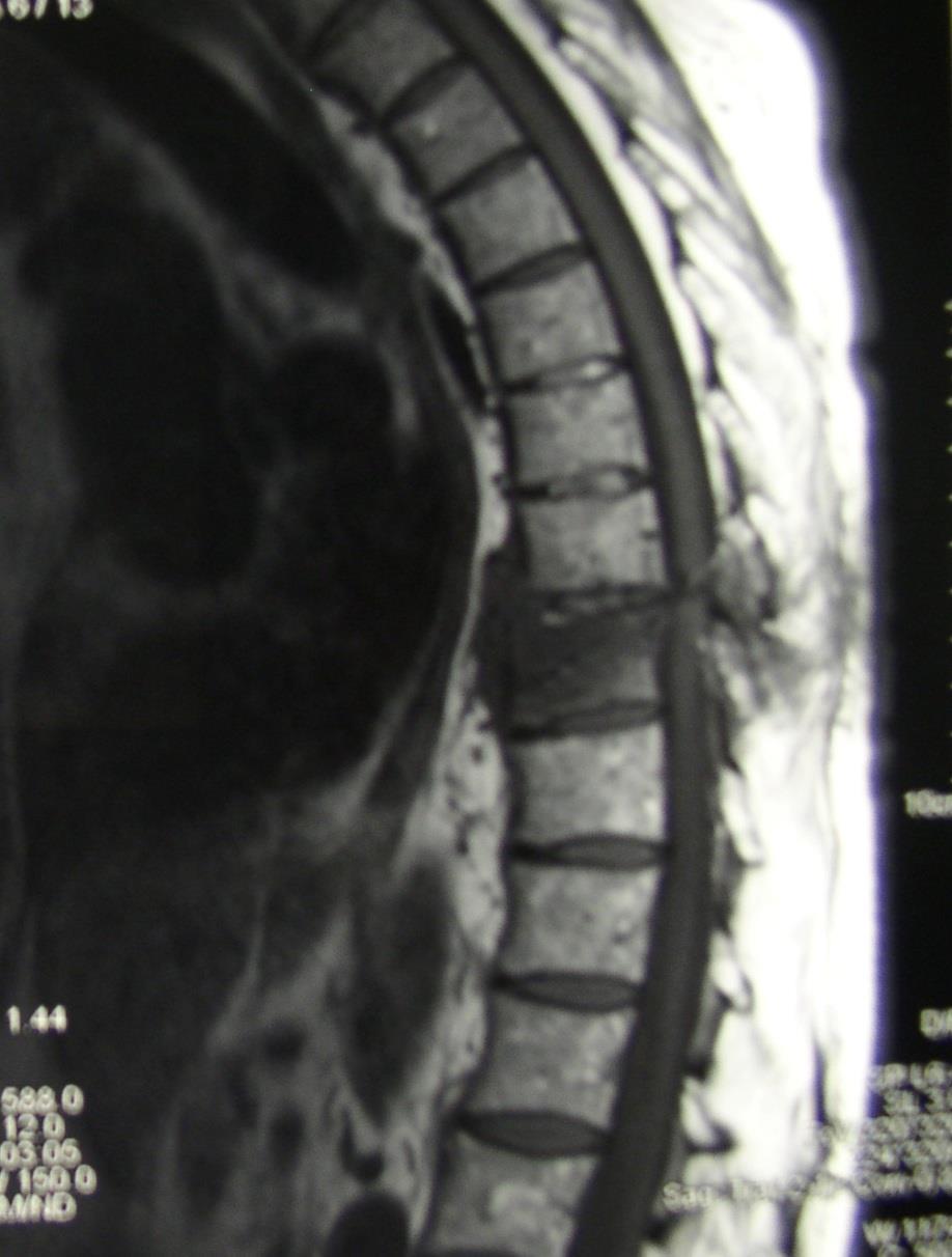 DIAGNOSTYKA RÓŻNICOWA ZŁAMANIA