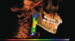 3D InVivo Dental dla jeszcze lepszej diagnostyki i precyzyjnego planowania zabiegów 9 x 14 cm Maksymalne pole obrazowania CBCT MONITOR MEDYCZNY!