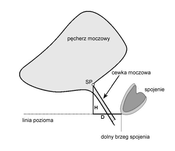 Rys. 3 Pomiar wysokości szyjki pęcherza (SP, bladder neck) za pomocą sonografii przedsionkowej wg Badera (Bader et al. 1997; zmodyfikowany przez Viereck et al. 2005).