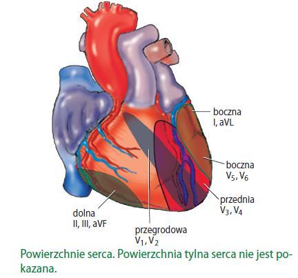 Powikłania zawału serca 3.