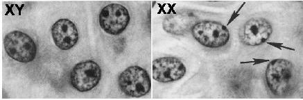 PŁEĆ CHROMATYNOWA inaktywacja genów/chromosomu X zachodzi poprzez: metylację Cytozyny w dinukleotydach CpG, modyfikowane histony powodują remodelowanie euchromatyny do heterochromatyny chromatyna