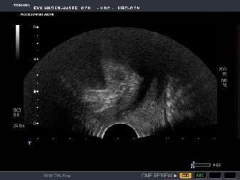 Sonografia