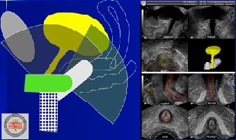 Pelvic Floor Sonografia Nowy nowy rodzaj diagnostyki uroginekologicznej nieinwazyjna bez środka