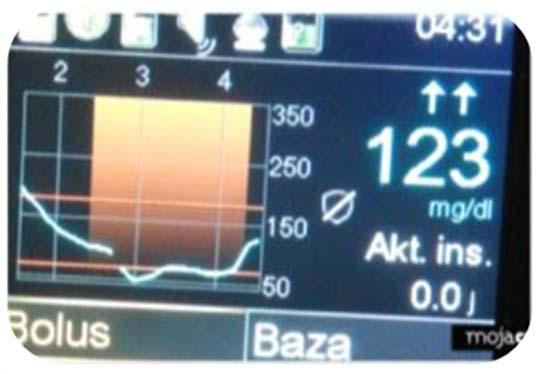 jest ilość aktywnej insuliny? Co będę robić później?