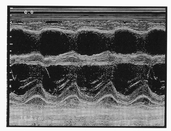 H odchylanie poziome - Odch.