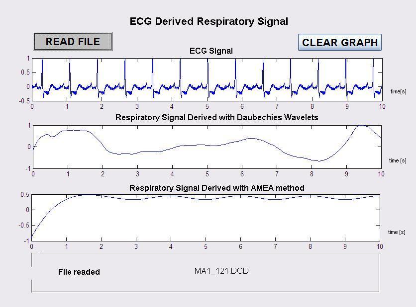 Przykładowe wykresy przebiegu sygnału oddechowego otrzymane przez algorytmy zaimplementowane w Matlabie : - dla plików z bazy cse : Rys.