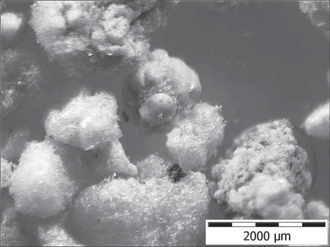 Dok adniejsze zobrazowanie mikrostruktury tego sorbentu umo liwi y obserwacje przy u yciu skaningowej mikroskopii elektronowej (Rys. 5). Analizy obrazów z SEM potwierdzaj p ytkow budow sorbentu Y.