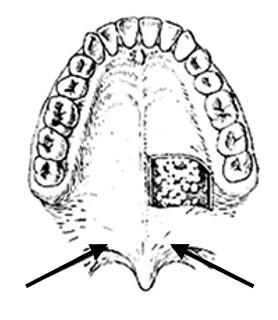 Na rysunku przedstawiono pierwszy przedtrzonowiec dolny. Strzałką zaznaczono A. oś długą zęba. B. oś długą korony. C. największą wypukłość względną zęba. D. największą wypukłość bezwzględną korony.
