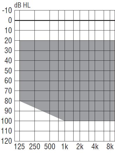 Aparat numer 3 Aparat cyfrowy, zauszny, technologia RIC (RITE) Zalecany zakres dopasowania (dopasowanie standardowe szary obszar, dopasowanie otwarte obszar ograniczony linią): Parametry według normy