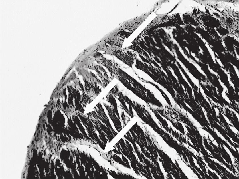 Mięsień brodawkowaty przegrodowy, 82 lata Naczynia krwionośne strzałki Figure 4. Septal papillary muscle, 82 yrs Blood vessels arrows Rycina 5.