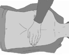 º uklęknij obok poszkodowanego, º ułóż nadgarstek jednej ręki na środku klatki piersiowej poszkodowanego, º ułóż nadgarstek drugiej ręki na już położonym, Ułóż nadgarstek jednej ręki na środku klatki