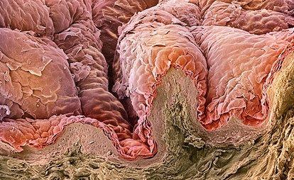 Różowa warstwa naskórka na tym zdjęciu, to warstwa rogowa (stratum corneum).