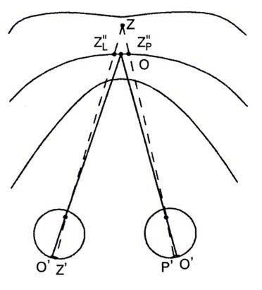 niekorespondujących miejscach siatkówek. Mówimy wtedy o dwunosowej poprzecznej dysparacji. Prawe oko widzi obraz Z P " przesunięty na prawo, a lewe oko obraz Z L " przesunięty na lewo. Powstaje tzw.