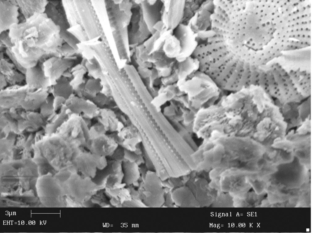 Charakterystyka osadów dennych... Rysunek 3. Fragmenty skorupek Melosira sp. (po lewej) i Stephanodiscus sp.