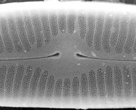angustum, fragment okrywy z porami w części apikalnej, widok od strony zewnętrznej (detail of external valve with apical pores field); 12